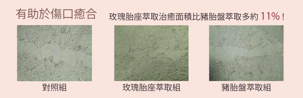 專利玫瑰胎座萃取— 植物胎盤素– 和聚國際生醫材料有限公司